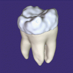 tooth