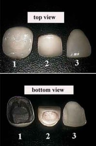 Crowns