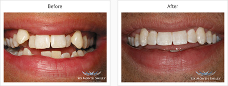 dentist leicester