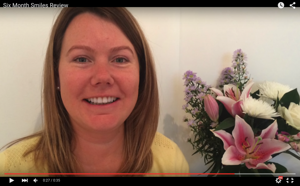 cosmetic brace treatment review 