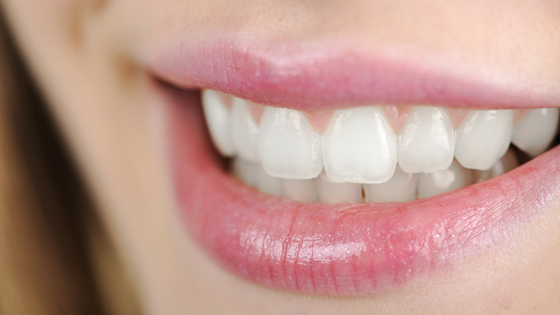 What causes translucent teeth