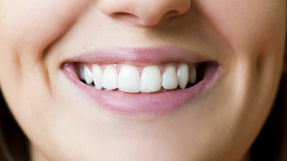 White filling on teeth